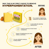 Kojic Acid & Turmeric Soap Bar